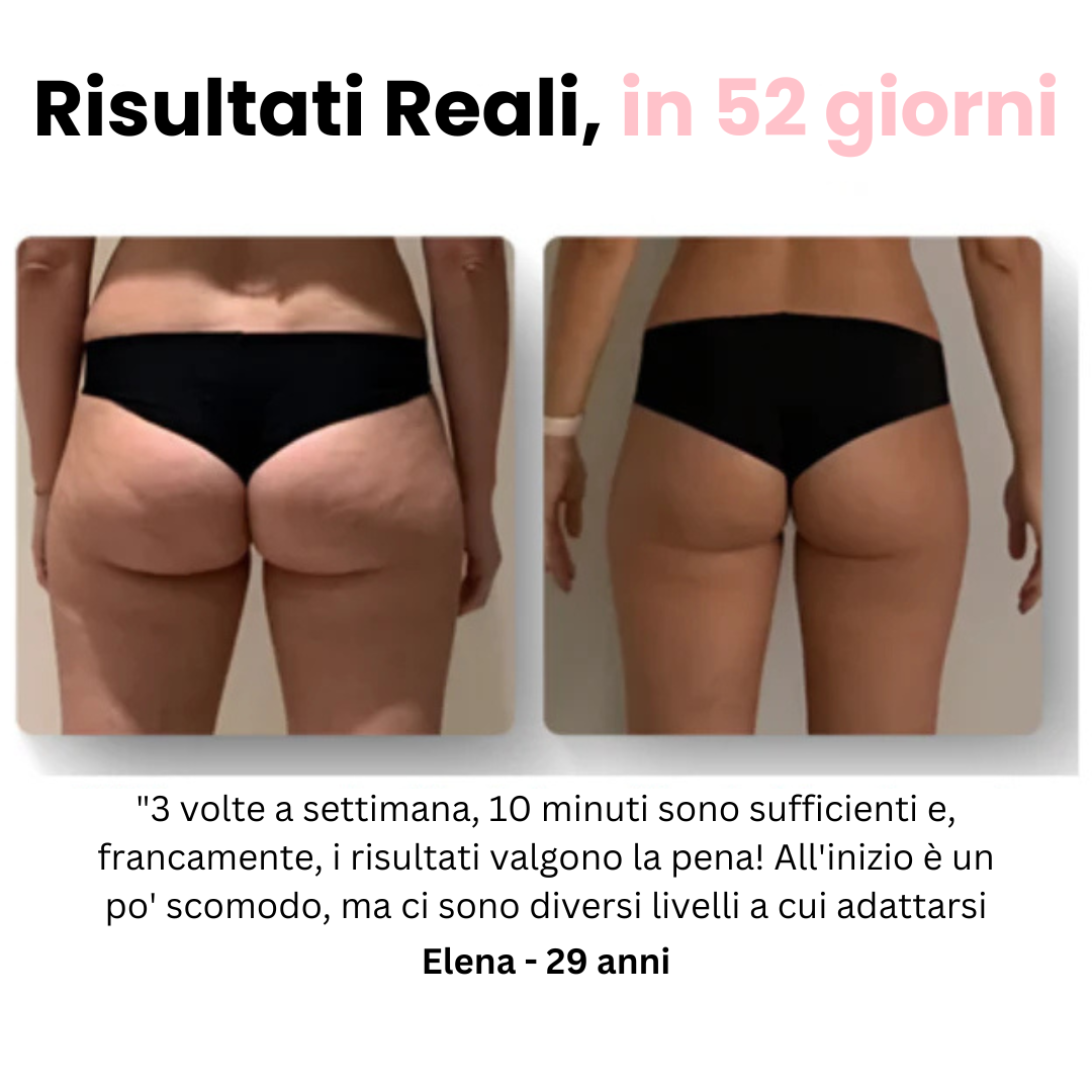 Velora™ - Massaggiatore Anti Cellulite
