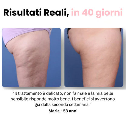 Velora™ - Massaggiatore Anti Cellulite